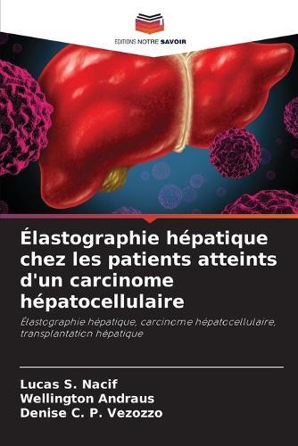 Élastographie hépatique chez les patients atteints d'un carcinome hépatocellulaire
