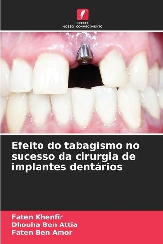 Efeito do tabagismo no sucesso da cirurgia de implantes dentários