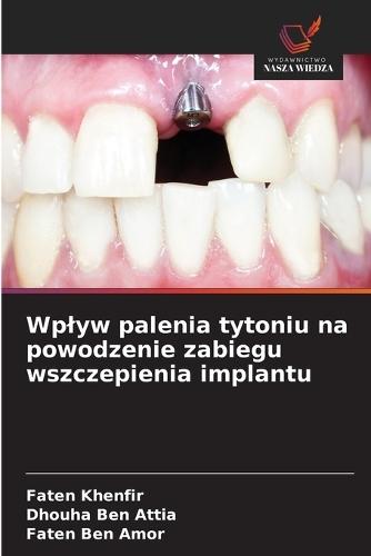 Wplyw palenia tytoniu na powodzenie zabiegu wszczepienia implantu