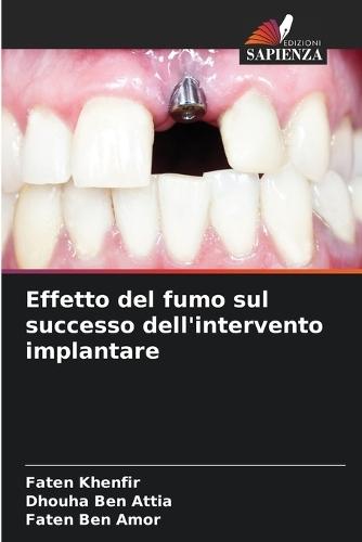 Effetto del fumo sul successo dell'intervento implantare