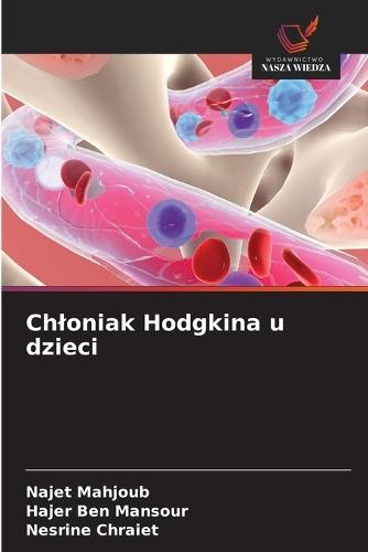 Chloniak Hodgkina u dzieci