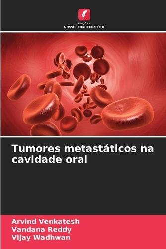 Tumores metastáticos na cavidade oral