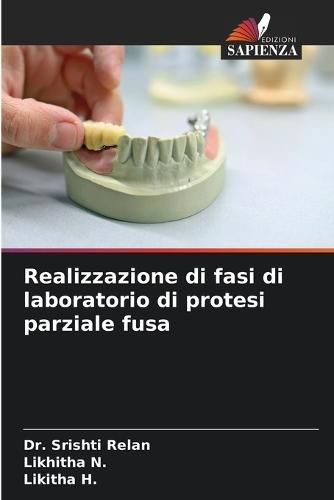 Realizzazione di fasi di laboratorio di protesi parziale fusa