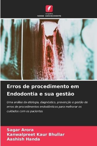 Erros de procedimento em Endodontia e sua gestão