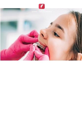 Aparelhos Pré-Ajustados À Borda [Aep]