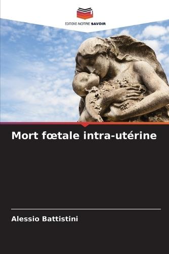 Mort foetale intra-utérine