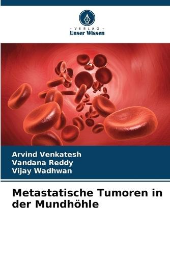 Metastatische Tumoren in der Mundhöhle