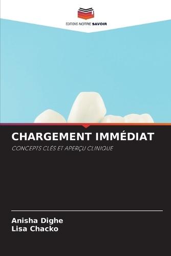 Chargement Immédiat