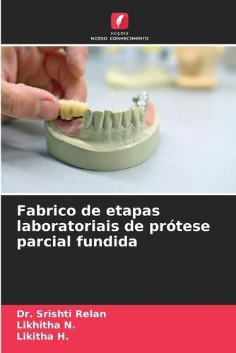 Fabrico de etapas laboratoriais de prótese parcial fundida