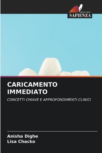 Caricamento Immediato