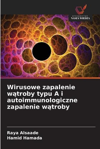 Wirusowe zapalenie w&#261;troby typu A i autoimmunologiczne zapalenie w&#261;troby