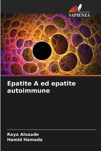 Epatite A ed epatite autoimmune