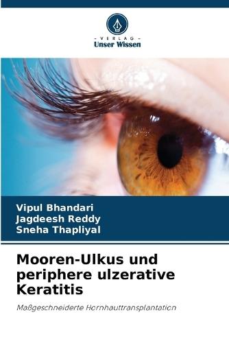 Mooren-Ulkus und periphere ulzerative Keratitis