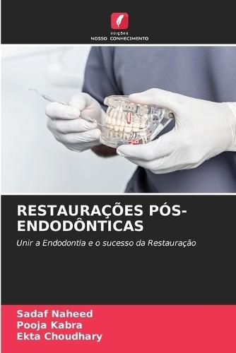 Restaurações Pós-Endodônticas