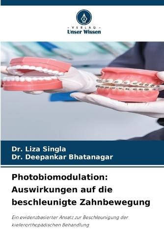 Photobiomodulation: Auswirkungen auf die beschleunigte Zahnbewegung