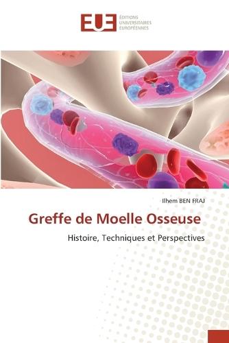 Greffe de Moelle Osseuse