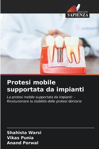 Protesi mobile supportata da impianti