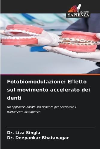 Fotobiomodulazione: Effetto sul movimento accelerato dei denti