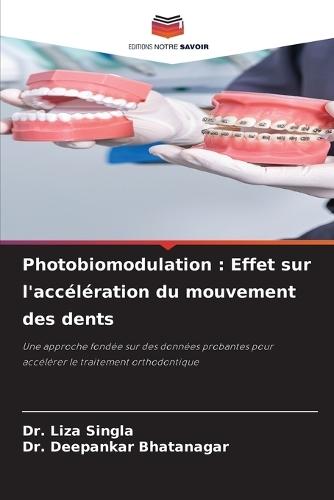 Photobiomodulation: Effet sur l'accélération du mouvement des dents