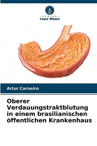 Oberer Verdauungstraktblutung in einem brasilianischen öffentlichen Krankenhaus