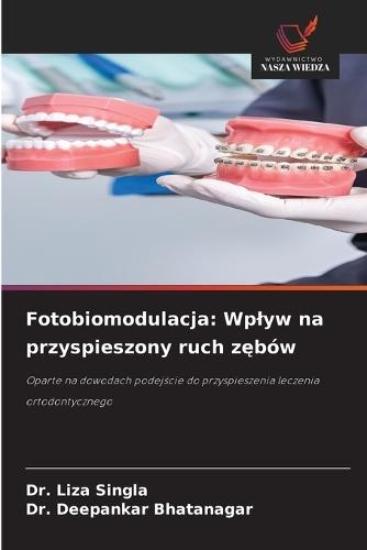 Fotobiomodulacja: Wplyw na przyspieszony ruch z&#281;bów