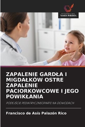 Zapalenie Gardla I Migdalków Ostre Zapalenie Paciorkowcowe I Jego Powiklania