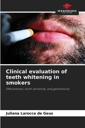 Clinical evaluation of teeth whitening in smokers