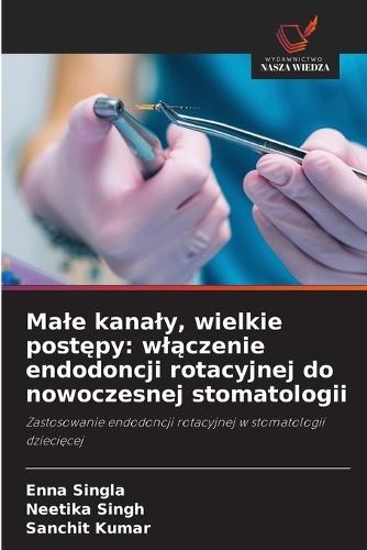 Male kanaly, wielkie postępy: wlączenie endodoncji rotacyjnej do nowoczesnej stomatologii