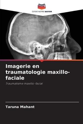 Imagerie en traumatologie maxillo-faciale