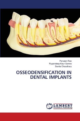 Osseodensification in Dental Implants