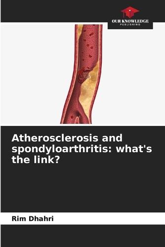 Atherosclerosis and spondyloarthritis: what's the link?