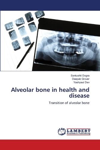 Alveolar bone in health and disease