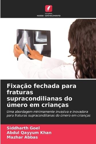 Fixação fechada para fraturas supracondilianas do úmero em crianças