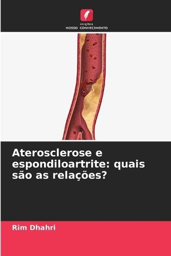 Aterosclerose e espondiloartrite: quais são as relações?