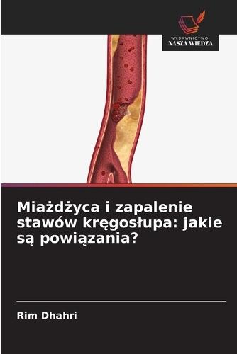 Miażdżyca i zapalenie stawów kręgoslupa: jakie są powiązania?
