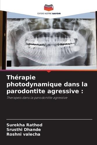 Thérapie photodynamique dans la parodontite agressive