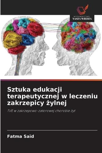 Sztuka edukacji terapeutycznej w leczeniu zakrzepicy żylnej
