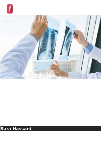 Taxas de recorrência do cancro após cirurgia conservadora da mama