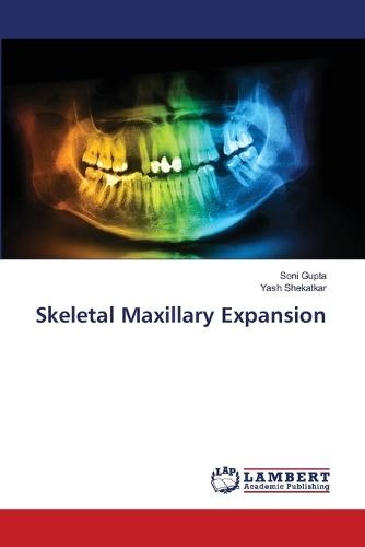 Skeletal Maxillary Expansion
