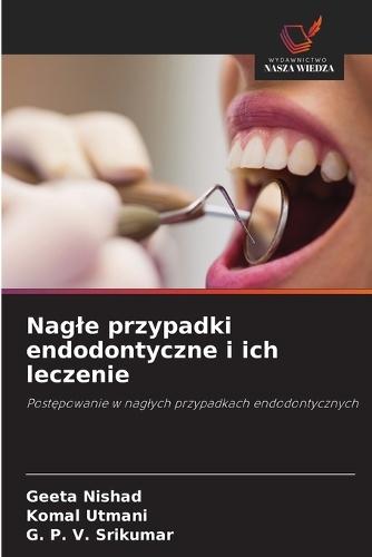 Nagle przypadki endodontyczne i ich leczenie