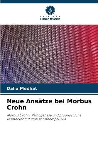 Neue Ansätze bei Morbus Crohn
