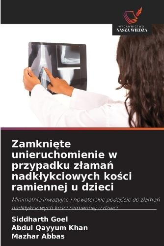 Zamknięte unieruchomienie w przypadku zlamań nadklykciowych kości ramiennej u dzieci