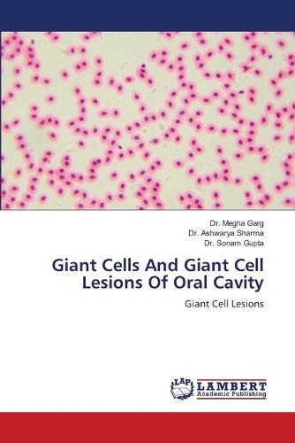 Giant Cells And Giant Cell Lesions Of Oral Cavity