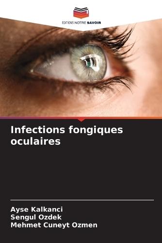 Infections fongiques oculaires