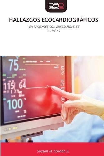 Hallazgos Ecocardiográficos