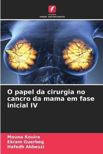 O papel da cirurgia no cancro da mama em fase inicial IV