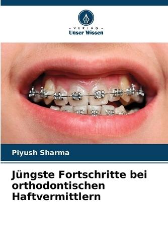 Jüngste Fortschritte bei orthodontischen Haftvermittlern