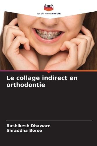 Le collage indirect en orthodontie
