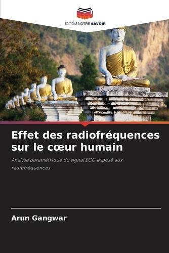 Effet des radiofréquences sur le coeur humain
