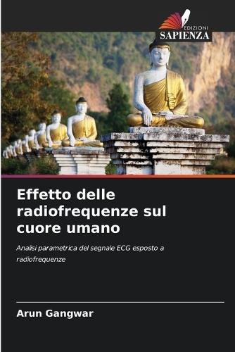 Effetto delle radiofrequenze sul cuore umano